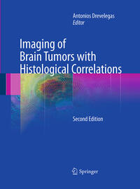 Vorderes Coverbild Imaging of Brain Tumors with Histological Correlations