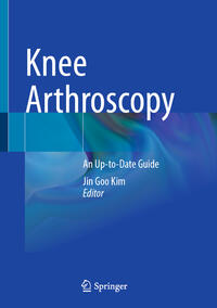 Vorderes Coverbild Knee Arthroscopy
