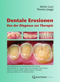 Vorderes Coverbild Dentale Erosionen