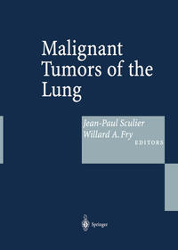 Vorderes Coverbild Malignant Tumors of the Lung