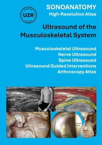 Vorderes Coverbild Sonoanatomy - High-Resolution Atlas - Ultrasound of the Musculoskeletal System