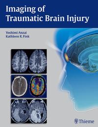 Vorderes Coverbild Imaging of Traumatic Brain Injury