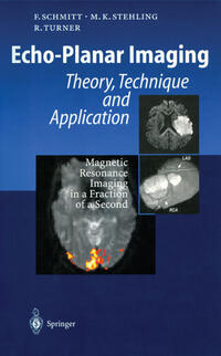Vorderes Coverbild Echo-Planar Imaging