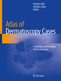 Vorderes Coverbild Atlas of Dermatoscopy Cases