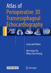 Vorderes Coverbild Atlas of Perioperative 3D Transesophageal Echocardiography