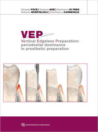 Vorderes Coverbild VEP Vertical Edgeless Preparation