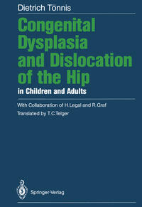 Vorderes Coverbild Congenital Dysplasia and Dislocation of the Hip in Children and Adults