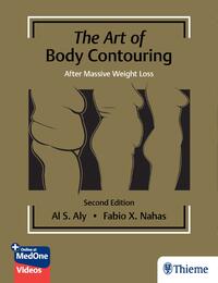 Vorderes Coverbild The Art of Body Contouring: After Massive Weight Loss