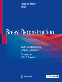 Vorderes Coverbild Breast Reconstruction