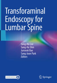 Vorderes Coverbild Transforaminal Endoscopy for Lumbar Spine