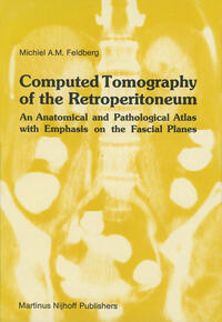 Vorderes Coverbild Computed Tomography of the Retroperitoneum