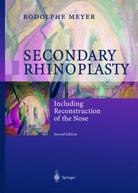 Vorderes Coverbild Secondary Rhinoplasty
