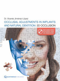Vorderes Coverbild Occlusal Adjustments in Implants and Natural Dentition: 3D Occlusion