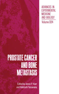 Vorderes Coverbild Prostate Cancer and Bone Metastasis