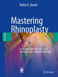 Vorderes Coverbild Mastering Rhinoplasty
