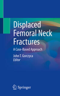 Vorderes Coverbild Displaced Femoral Neck Fractures