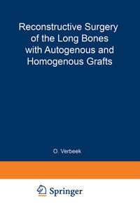 Vorderes Coverbild Reconstructive Surgery of the Long Bones with Autogenous and Homogenous Grafts