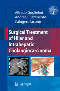 Vorderes Coverbild Surgical Treatment of Hilar and Intrahepatic Cholangiocarcinoma