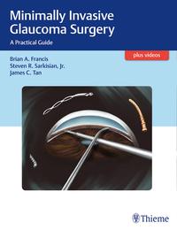 Vorderes Coverbild Minimally Invasive Glaucoma Surgery