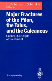 Vorderes Coverbild Major Fractures of the Pilon, the Talus, and the Calcaneus