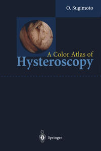 Vorderes Coverbild A Color Atlas of Hysteroscopy