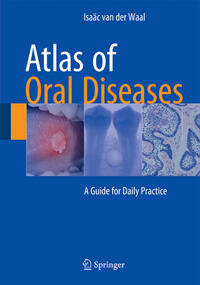 Vorderes Coverbild Atlas of Oral Diseases