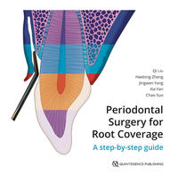 Vorderes Coverbild Periodontal Surgery for Root Coverage