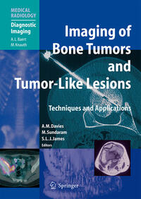 Vorderes Coverbild Imaging of Bone Tumors and Tumor-Like Lesions