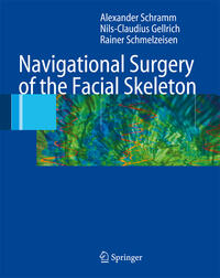 Vorderes Coverbild Navigational Surgery of the Facial Skeleton
