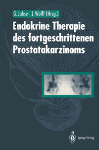 Vorderes Coverbild Endokrine Therapie des fortgeschrittenen Prostatakarzinoms