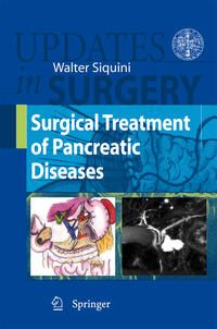 Vorderes Coverbild Surgical Treatment of Pancreatic Diseases