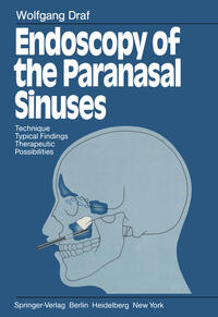 Vorderes Coverbild Endoscopy of the Paranasal Sinuses