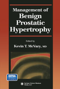 Vorderes Coverbild Management of Benign Prostatic Hypertrophy