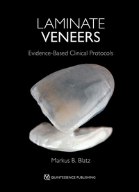 Vorderes Coverbild Laminate Veneers