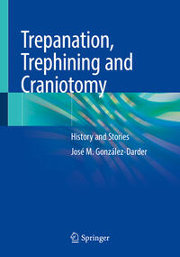 Vorderes Coverbild Trepanation, Trephining and Craniotomy