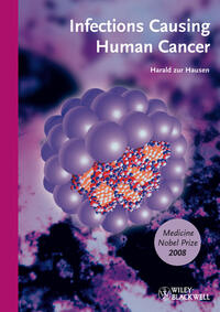 Vorderes Coverbild Infections Causing Human Cancer