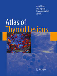 Vorderes Coverbild Atlas of Thyroid Lesions