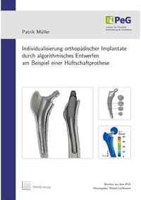 Vorderes Coverbild Individualisierung orthopädischer Implantate durch algorithmisches Entwerfen am Beispiel einer Hüftschaftprothese