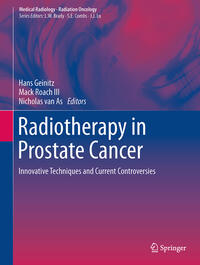 Vorderes Coverbild Radiotherapy in Prostate Cancer