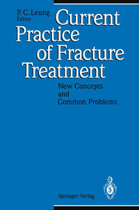 Vorderes Coverbild Current Practice of Fracture Treatment