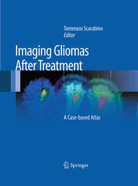 Vorderes Coverbild Imaging Gliomas After Treatment