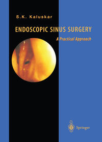 Vorderes Coverbild Endoscopic Sinus Surgery