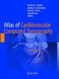 Vorderes Coverbild Atlas of Cardiovascular Computed Tomography