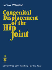 Vorderes Coverbild Congenital Displacement of the Hip Joint