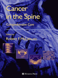 Vorderes Coverbild Cancer in the Spine
