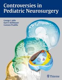 Vorderes Coverbild Controversies in Pediatric Neurosurgery