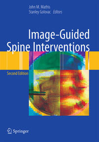 Vorderes Coverbild Image-Guided Spine Interventions