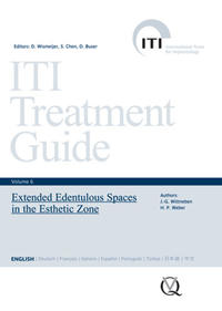 Vorderes Coverbild Extended Edentulous Spaces in the Esthetic Zone