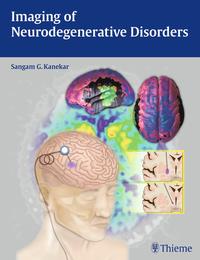 Vorderes Coverbild Imaging of Neurodegenerative Disorders
