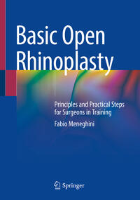 Vorderes Coverbild Basic Open Rhinoplasty